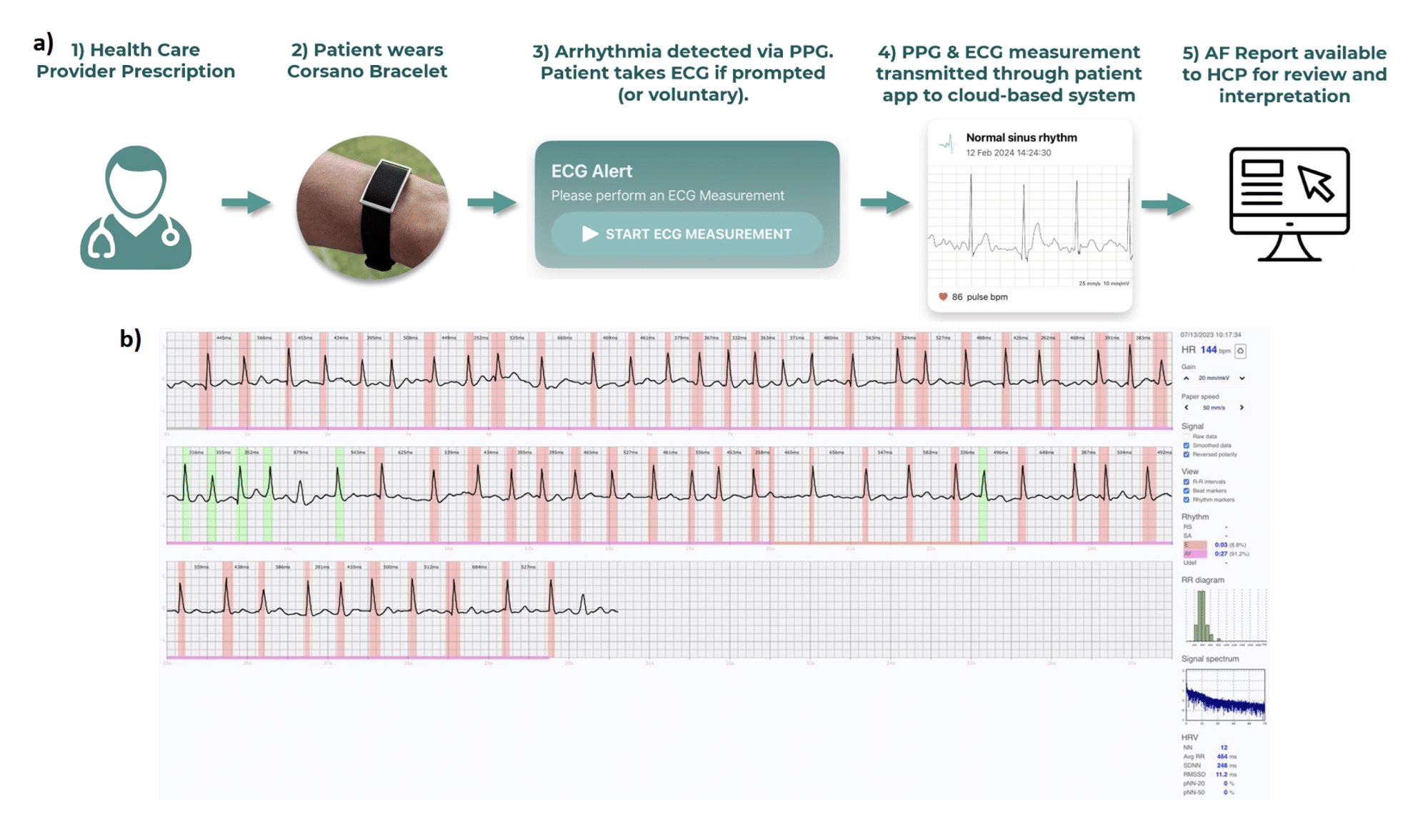 CardioWatch AFIB detection validation study data plot
